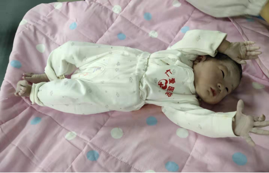 胎儿脐带绕颈3周，医生助力乐成生产