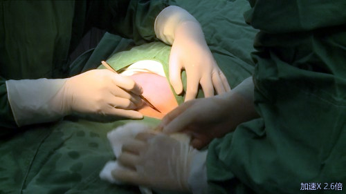 武汉仁爱在首届天下产科手术手艺大赛中获奖