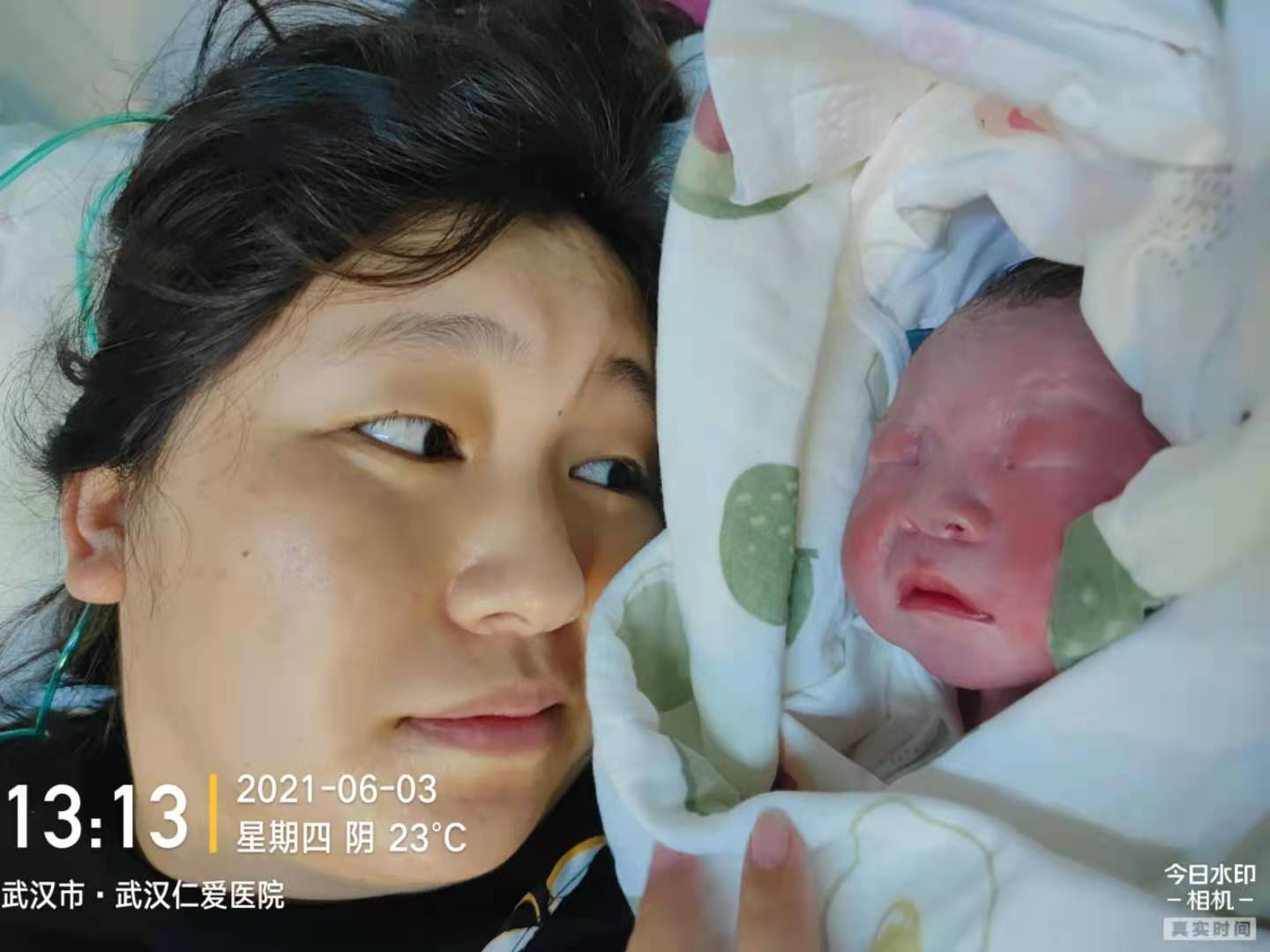 瘢痕子宫顺产，圆妈妈顺产梦